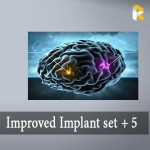 Improved Implant set + 5